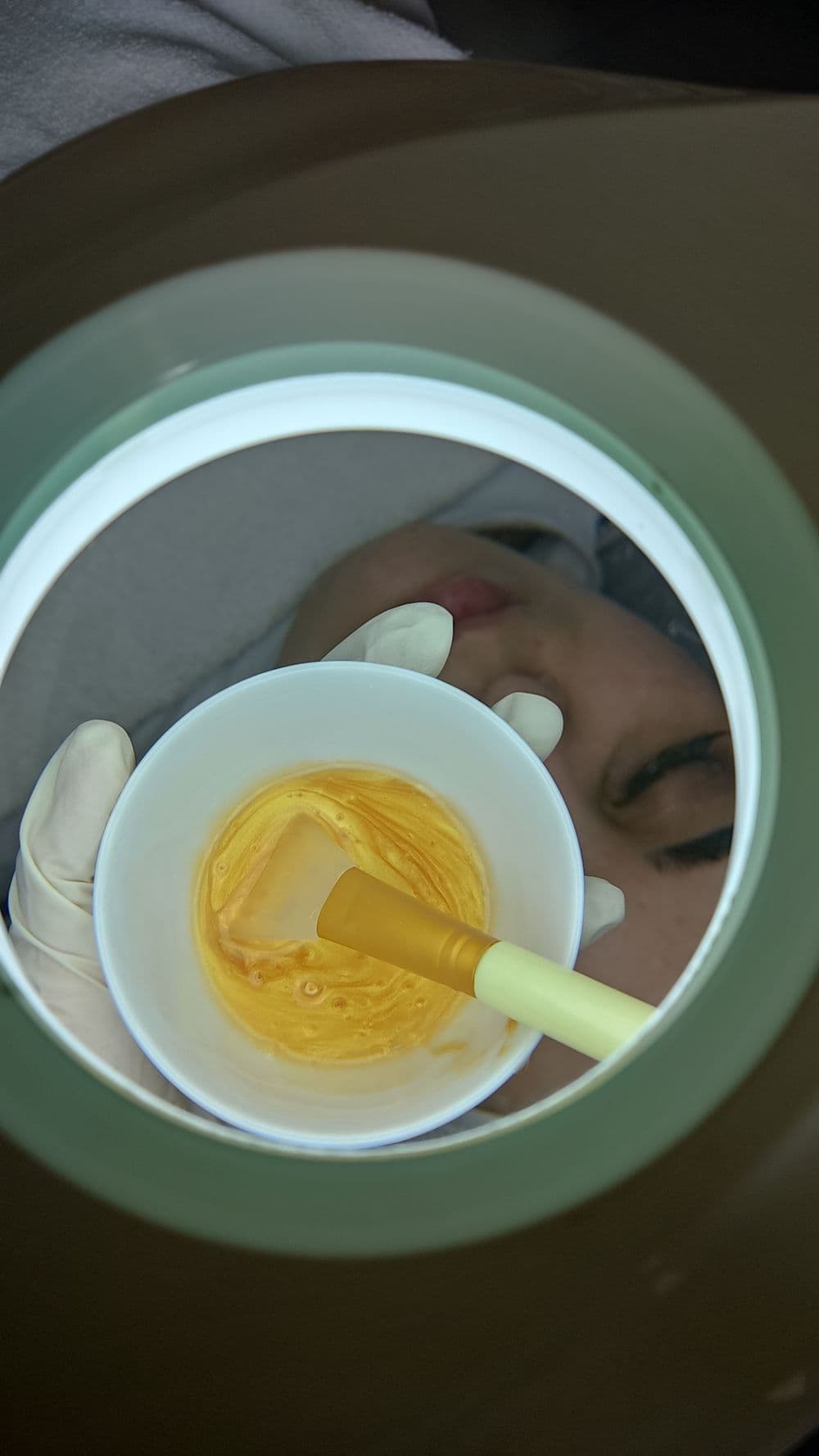 Skincare no pós-procedimento: como cuidar da pele